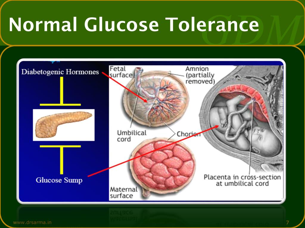 PPT - Gestational Diabetes Mellitus PowerPoint Presentation, free ...