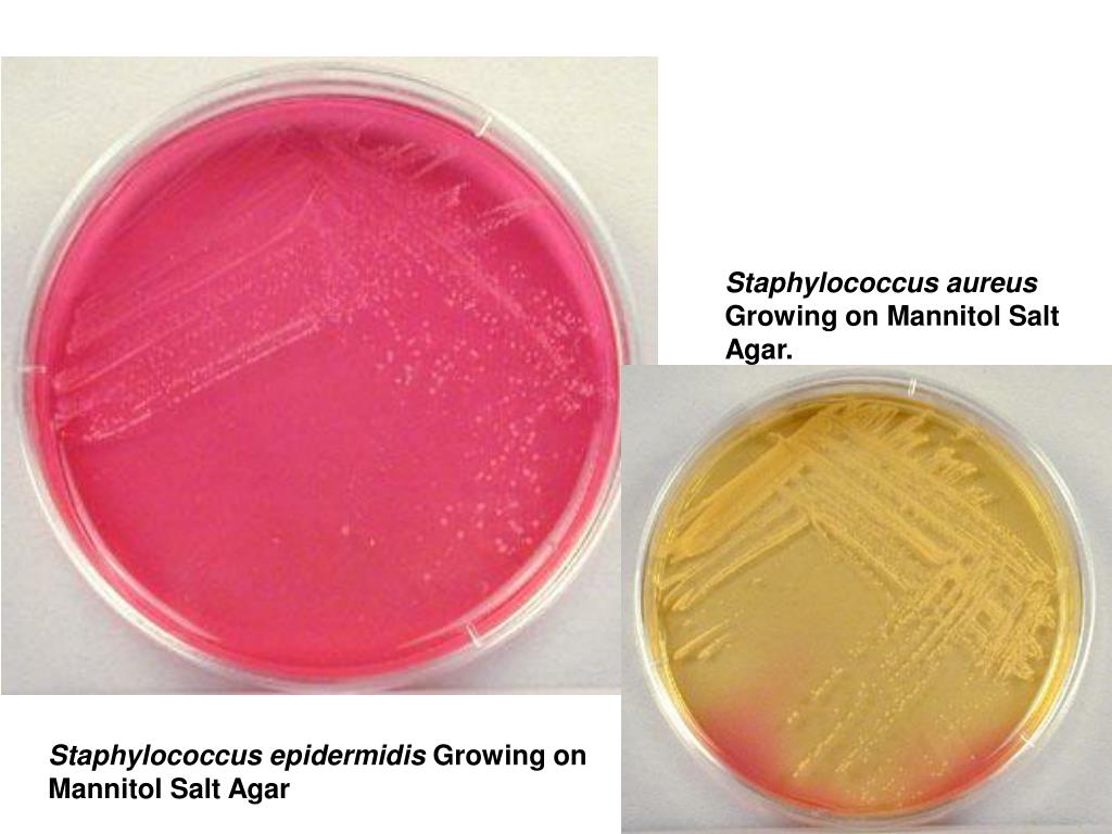 Staphylococcus aureus среда. Маннитол солевой агар. Маннит солевой агар. Молочно солевой агар стафилококк.