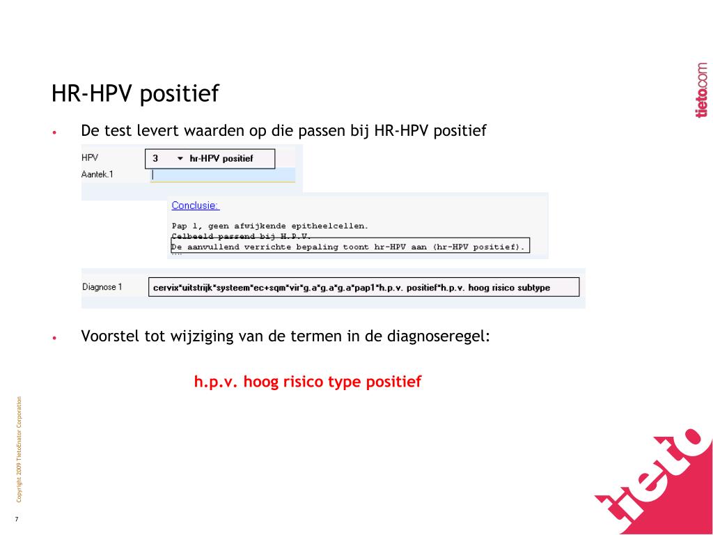 PPT - Tieto Kennis. Betrokkenheid. Resultaat. PowerPoint Presentation