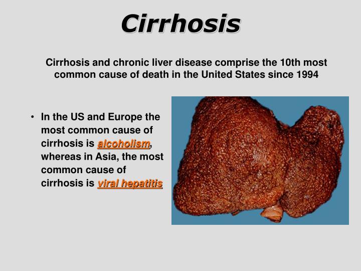 cirrhosis of the liver a chronic cirrhosis of the liver a chronic
