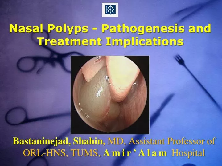 nasal polyps pathogenesis and treatment implications n.