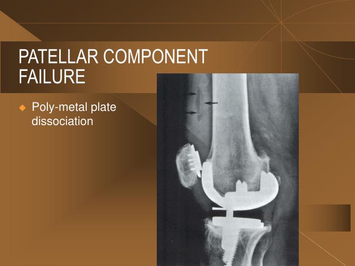ppt extensor mechanism problems in total knee patella femoral syndrome