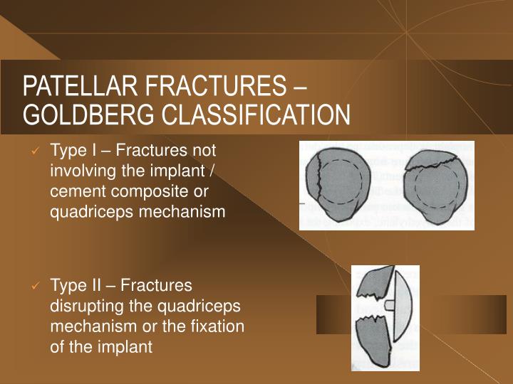 PPT - EXTENSOR MECHANISM PROBLEMS IN TOTAL KNEE ARTHROPLASTY PowerPoint ...