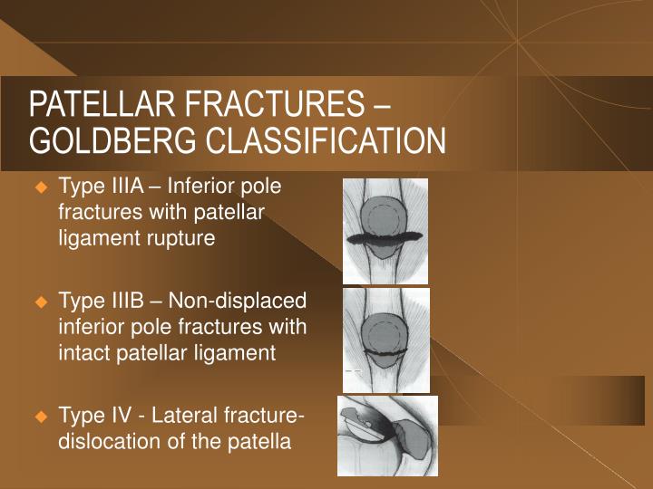 PPT - EXTENSOR MECHANISM PROBLEMS IN TOTAL KNEE ARTHROPLASTY PowerPoint ...