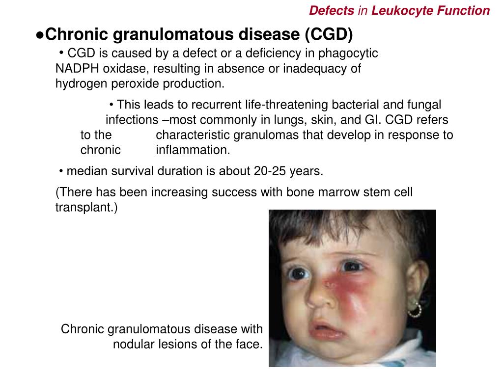 PPT - Understanding Leukocytes: Clinical Implications of Functional ...