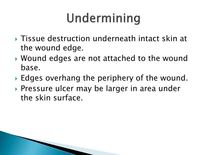 undermine defined undermine defined