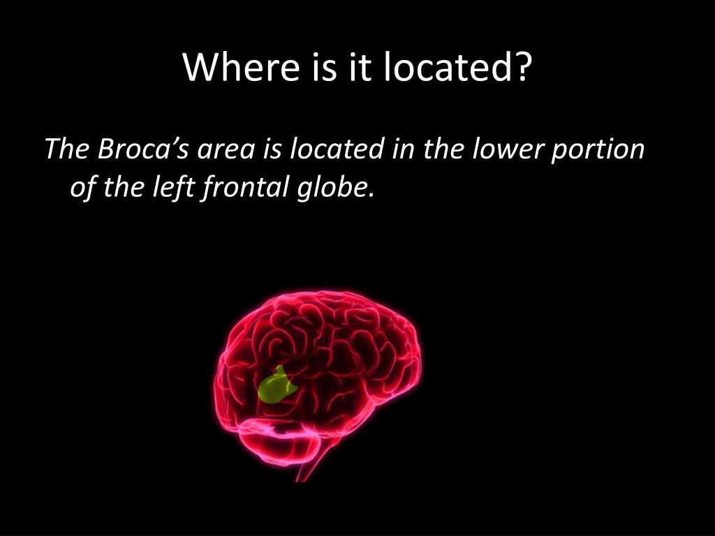 Wernicke's & Broca's aphasia Brain & Language LING 411/412/489