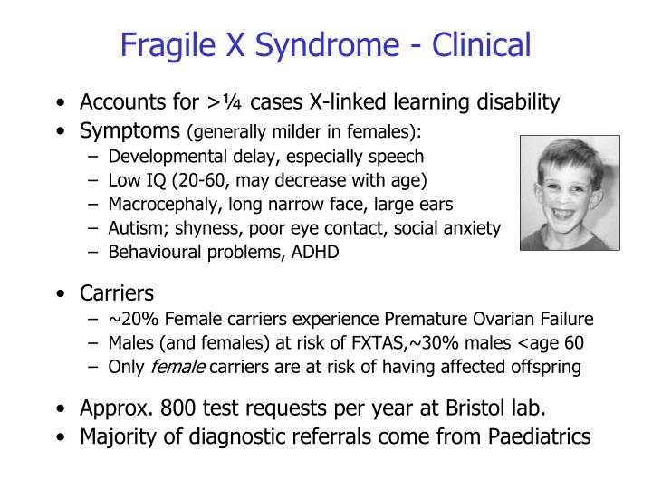 Fragile X Syndrome Female Symptoms