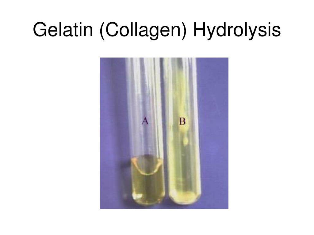 gelatin hydrolysis test e coli gelatin hydrolysis test e coli