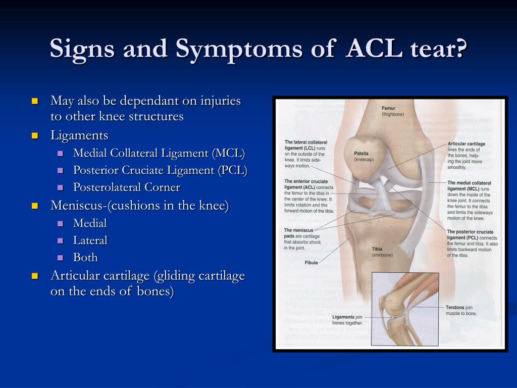 Ppt An Overview Of Anterior Cruciate Ligament Injurie - vrogue.co