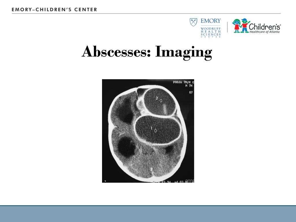 PPT - Pediatric Critical Care Medicine Emory University Children’s ...