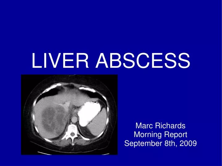 liver abscess case study slideshare