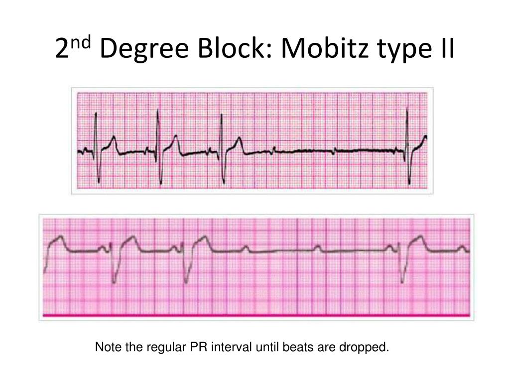 Ppt acls rhythms cheat sheet powerpoint presentation free download