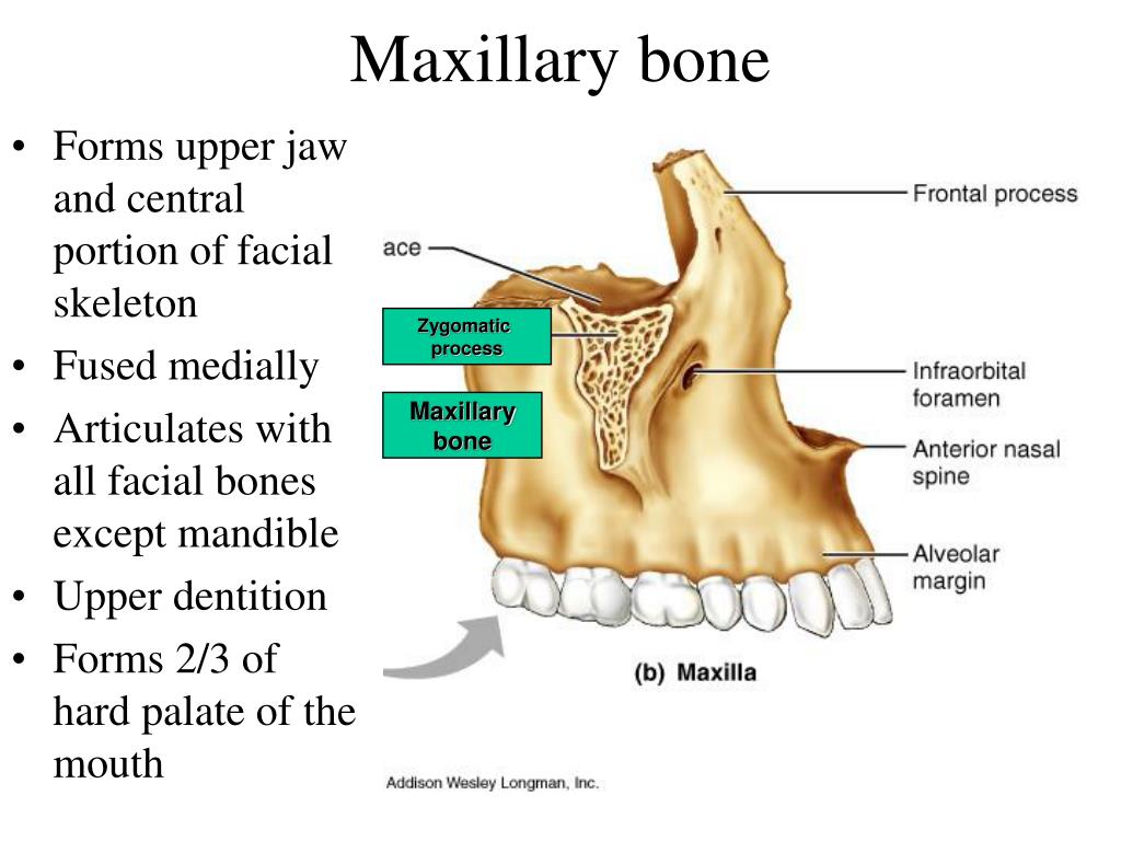The bones form. Maxillary Bone. Tuber Maxillae челюсть. Maxillary process. Zygomatic process of the Maxilla.