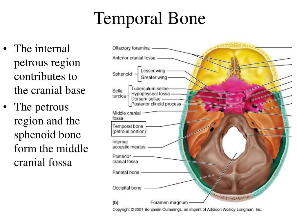 The bones form. Темпорал бонез. Petrous portion of temporal Bone. Petrous Part of the temporal Bone. Foramina of the temporal Bone.