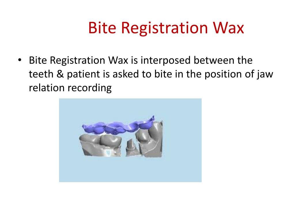 PPT - Dental waxes PowerPoint Presentation, free download - ID:6698340