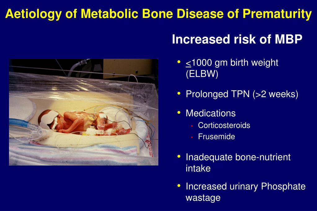 PPT - Metabolic Bone Disease of Prematurity PowerPoint ...