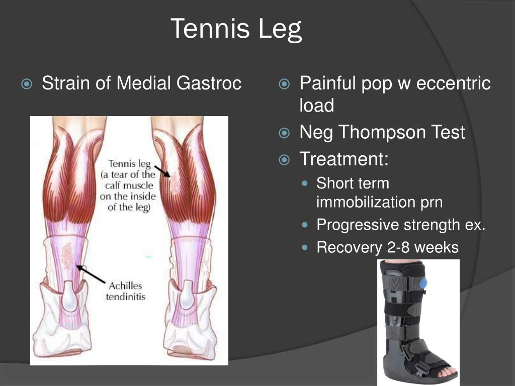 PPT LOWER Extremity Overuse Injuries PowerPoint