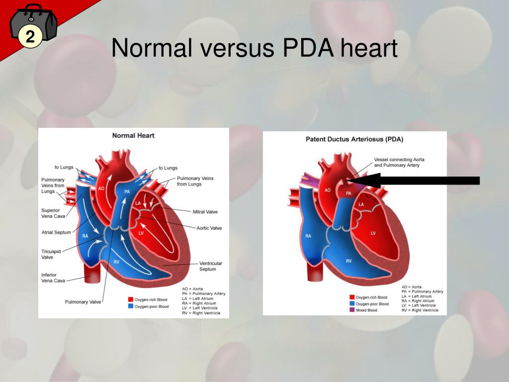 PPT - Heartworms and Heart Murmurs PowerPoint Presentation, free ...