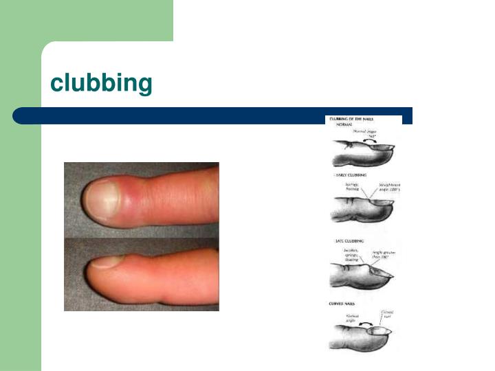 PPT General Physical Examination PowerPoint Presentation ID6711564