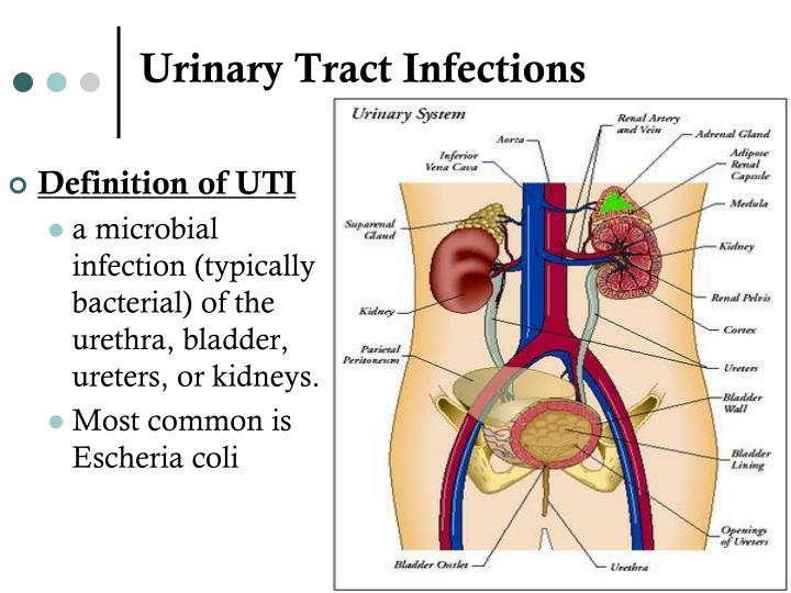 PPT - UTI Prevention in Patients with Foley Catheters PowerPoint ...