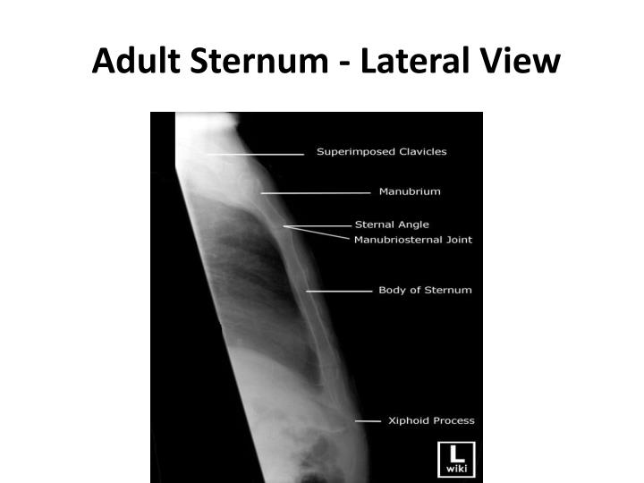 PPT - Radiographic Anatomy NMT 242 lecture 3 PowerPoint Presentation ...