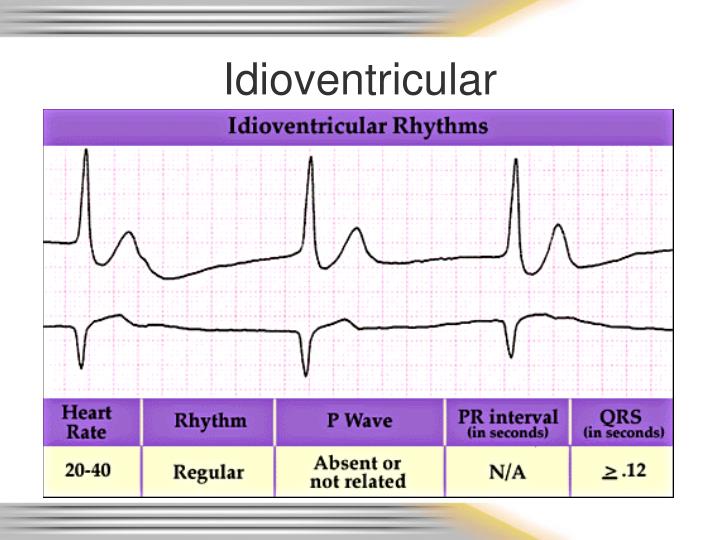 PPT - Rhythm & 12 Lead EKG Review PowerPoint Presentation - ID:6720077