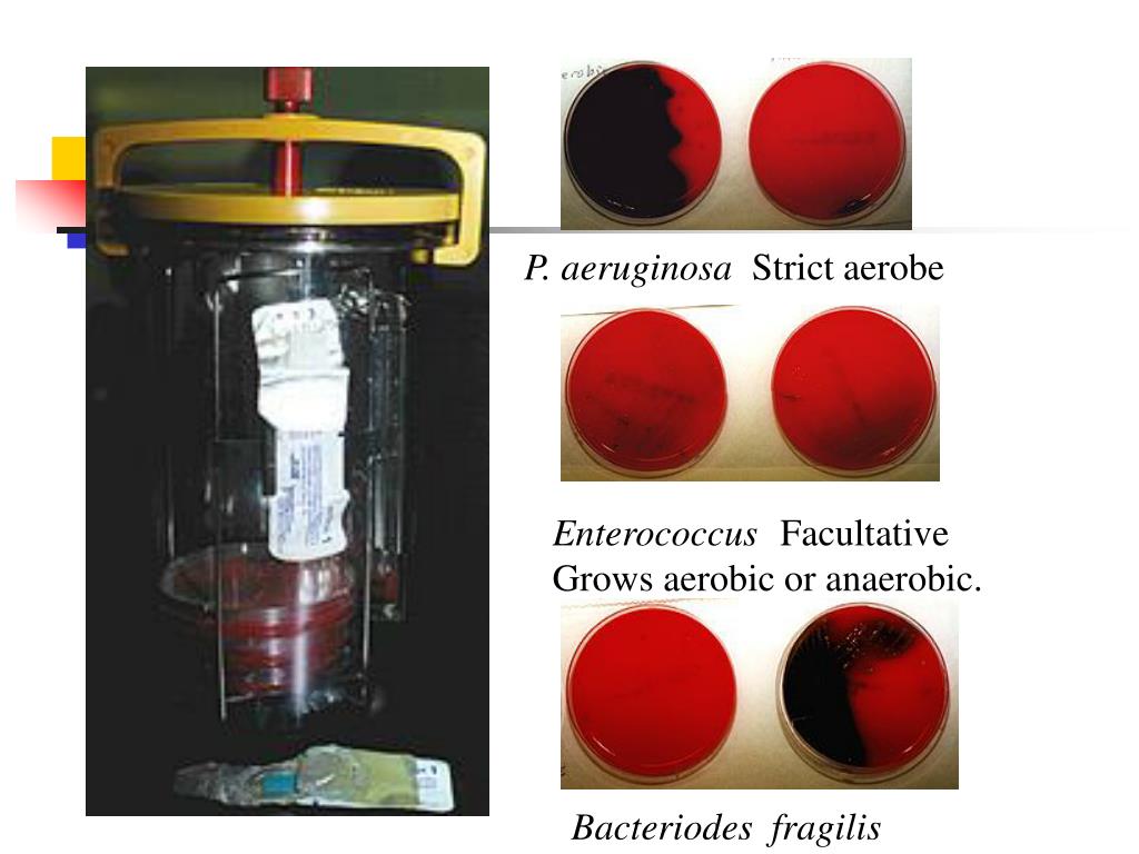 PPT Anaerobic Culture Techniques PowerPoint Presentation, free PPT Anaerobic Culture Techniques PowerPoint Presentation, free