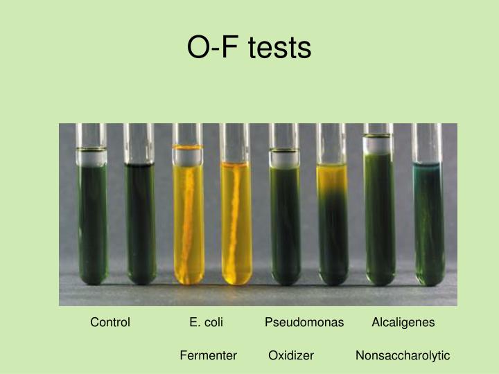 Ocef Testing PPT - Microbiology Unknown Lab PowerPoint Presentation - ID:6730041