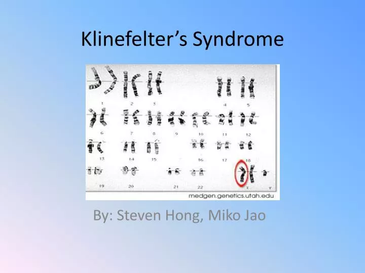 PPT - Klinefelter’s Syndrome PowerPoint Presentation - ID:6730569