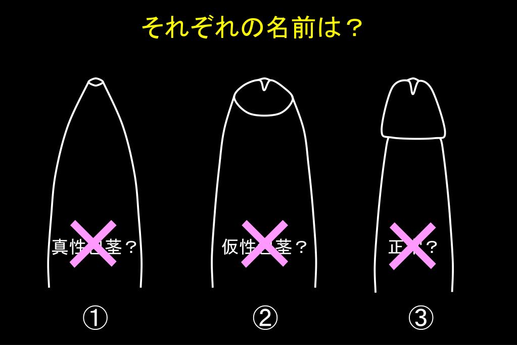 Ppt 知っておきたい 自分の性 相手の性 おちんちんの常識 Powerpoint Presentation Id Ppt 知っておきたい 自分の性 相手の性 おちんちんの常識 Powerpoint Presentation Id