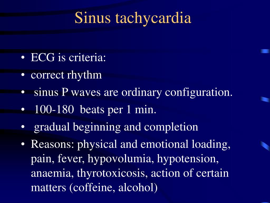 Ppt Arrhythmias Of Heart Powerpoint Presentation Free Download Id