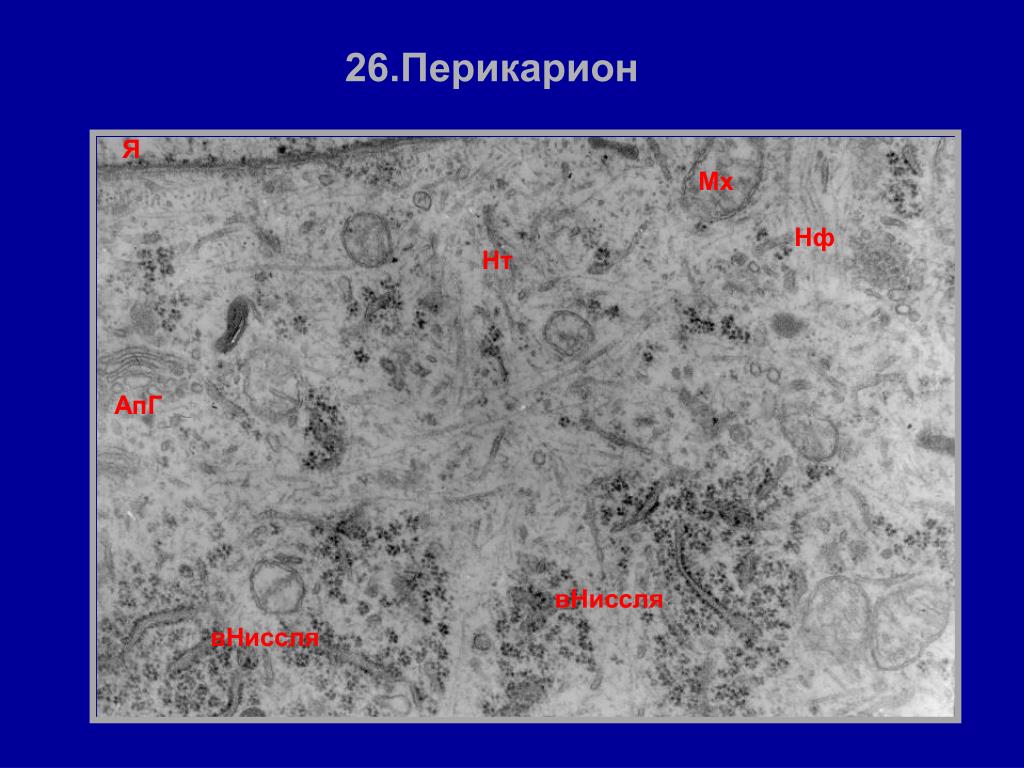 Какую функцию выполняет структура представленная на микрофотографии. Перикарион это гистология. Перикарион препарат. Электронная микрофотография митохондрии. Электронная микрофотография гипофиза.