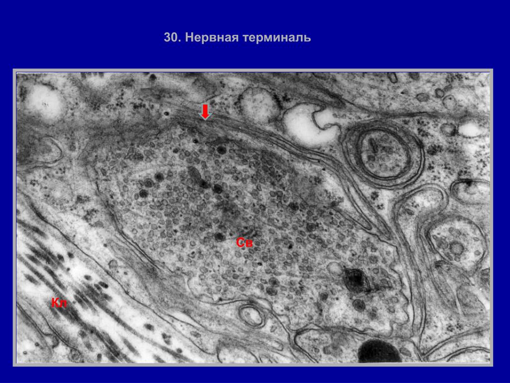 Какую функцию выполняет структура представленная на микрофотографии. Олигодендроциты микрофотографии. Электронная микрофотография. Нервная терминаль микрофотографии. Нервные терминали это.