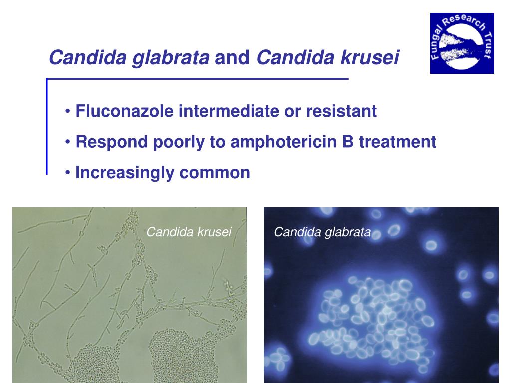 Candida albicans лечение. Candida glabrata норма. Candida glabrata чувствительность. С. glabrata.