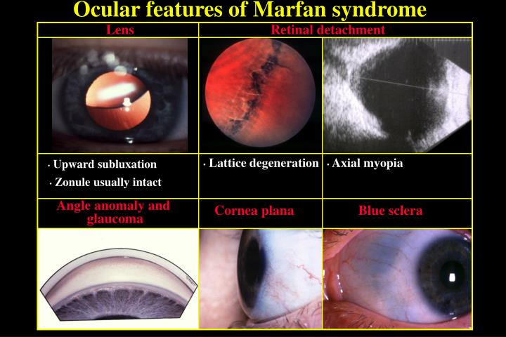 PPT ECTOPIA LENTIS PowerPoint Presentation ID6747605