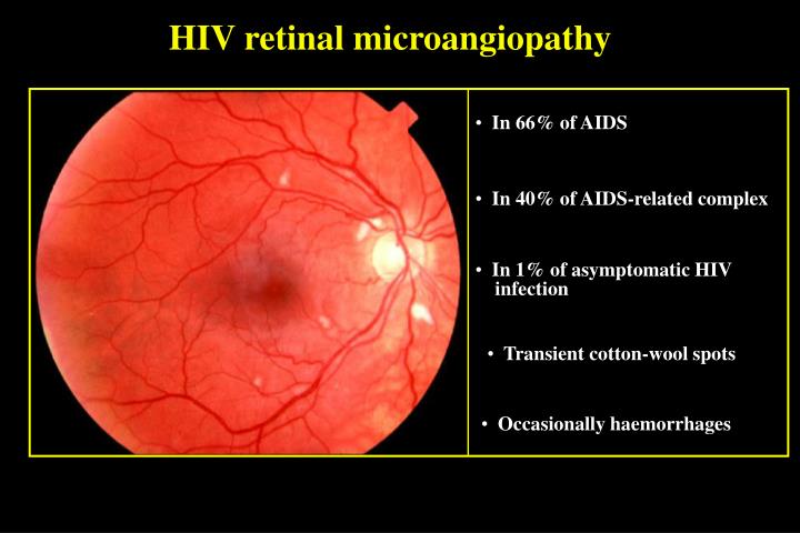 Ppt Uveal Infections And Infestations Powerpoint Presentation Id