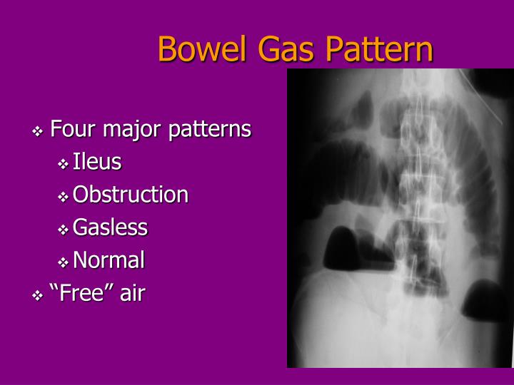 PPT BASIC GI RADIOLOGY THE “FLAT” PLATE PowerPoint Presentation ID