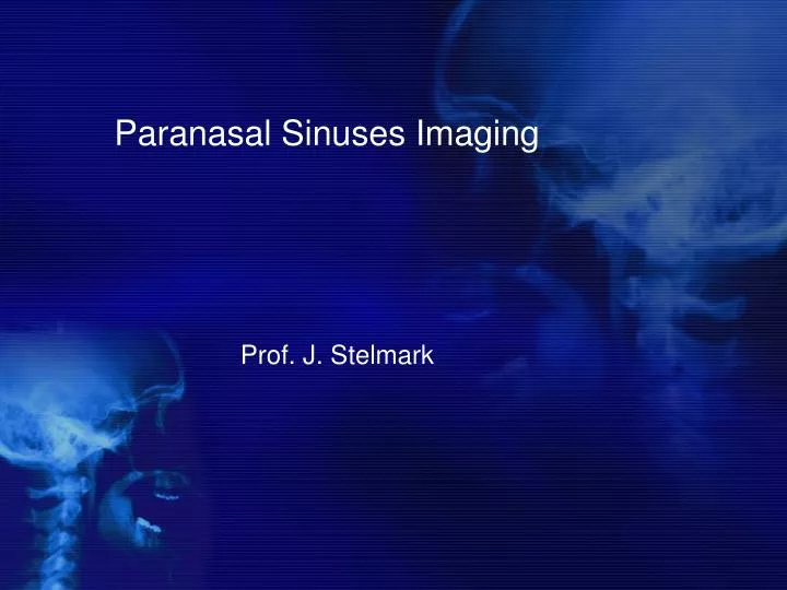 Ppt Paranasal Sinuses Imaging Powerpoint Presentation Free Download Id