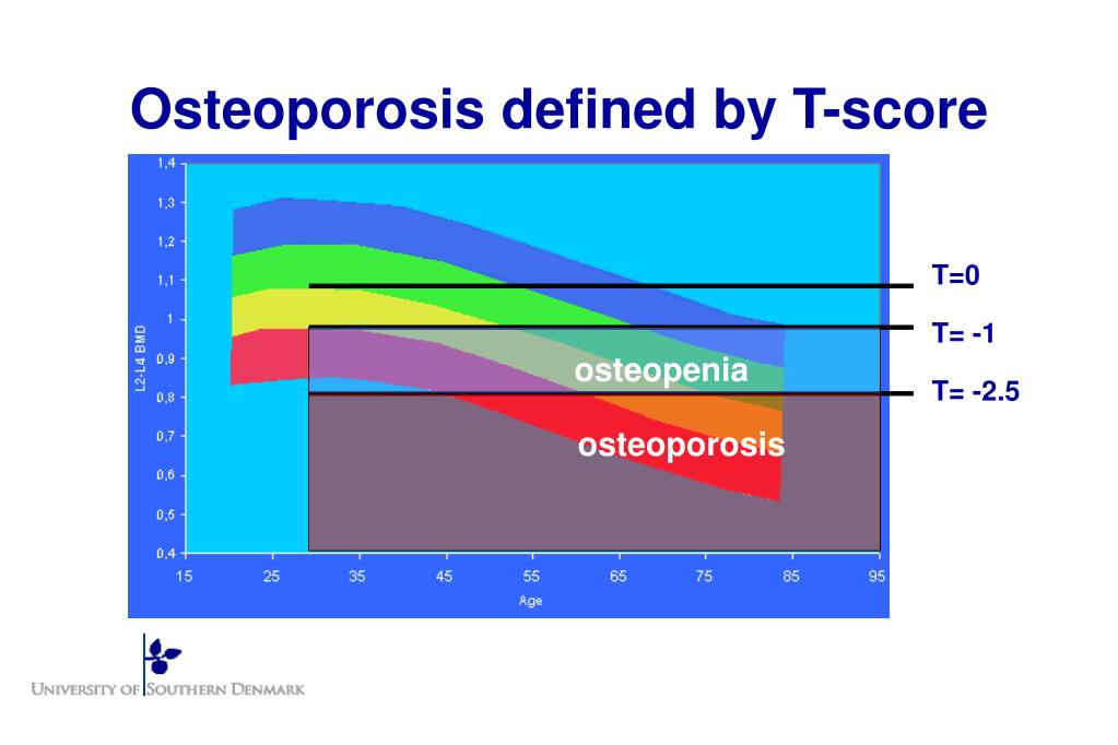 osteoporosis-t-score-chart