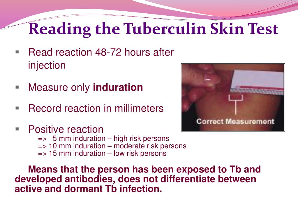 PPT Tuberculosis A Bacterial Lung Infection PowerPoint Presentation 