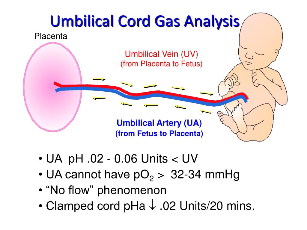 PPT Neonatal Encephalopathy The Relationship to Cerebral Palsy