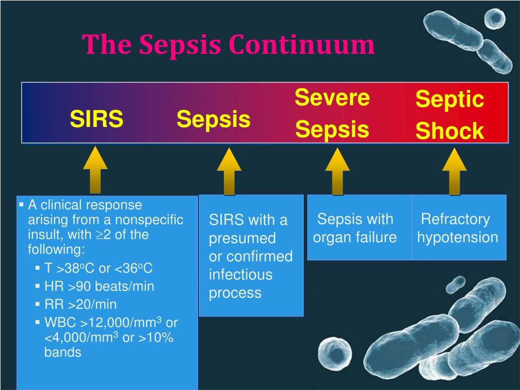 sepsis powerpoint presentation for nurses