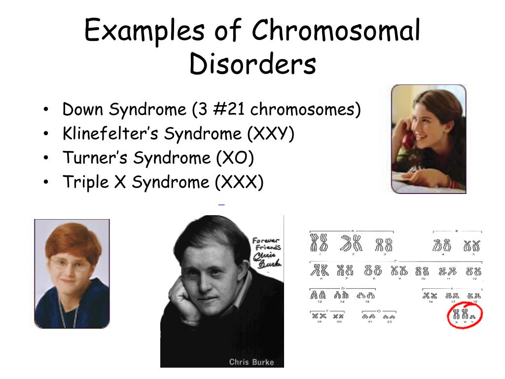 3 X Chromosomes Disorder