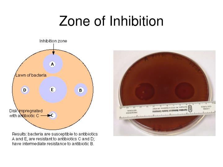 Zone Of Inhibition Chart