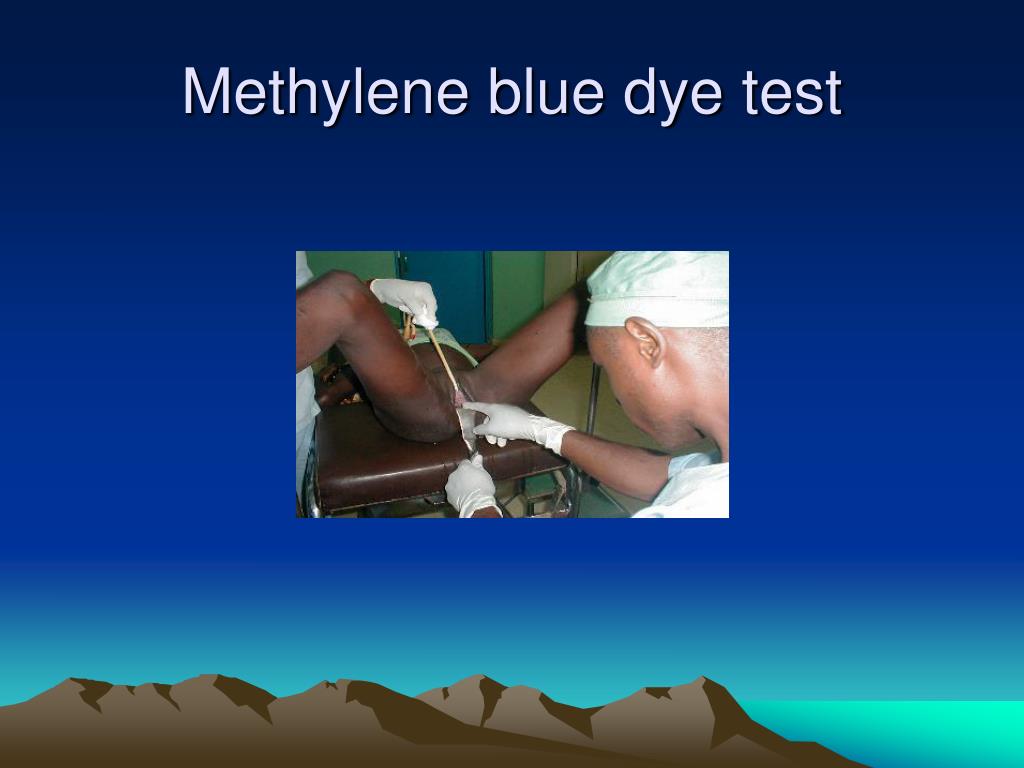 PPT OBSTETRIC FISTULA IN AFRICA Challenges to quality delivery of