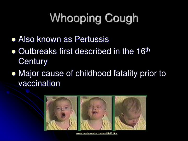 Pertussis whooping cough ppt to pdf