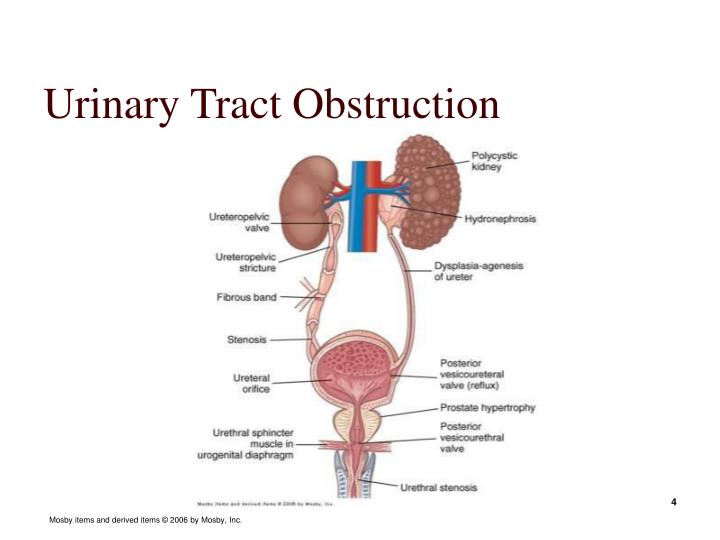 PPT - Alterations of Renal and Urinary Tract Function PowerPoint ...