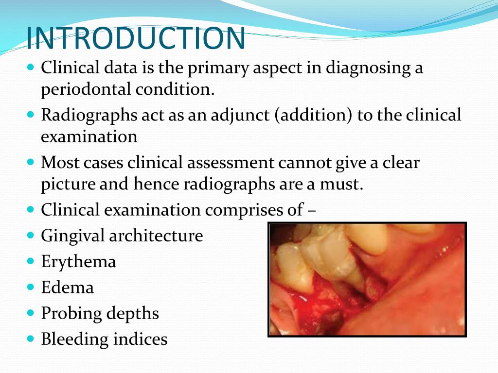 paper presentation topics in periodontics