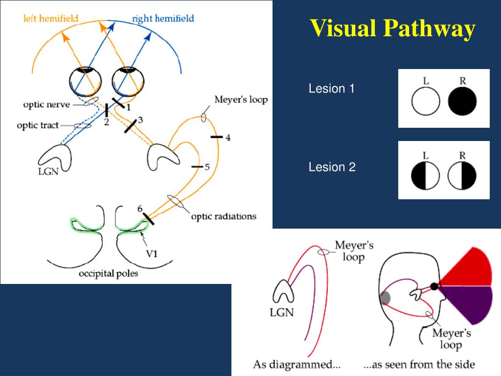 PPT - Visual Pathway PowerPoint Presentation, free download - ID:6822109